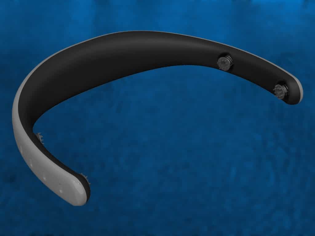 Pesquisadoras paulistanas desenvolvem wearable para identificar crises de epilepsia