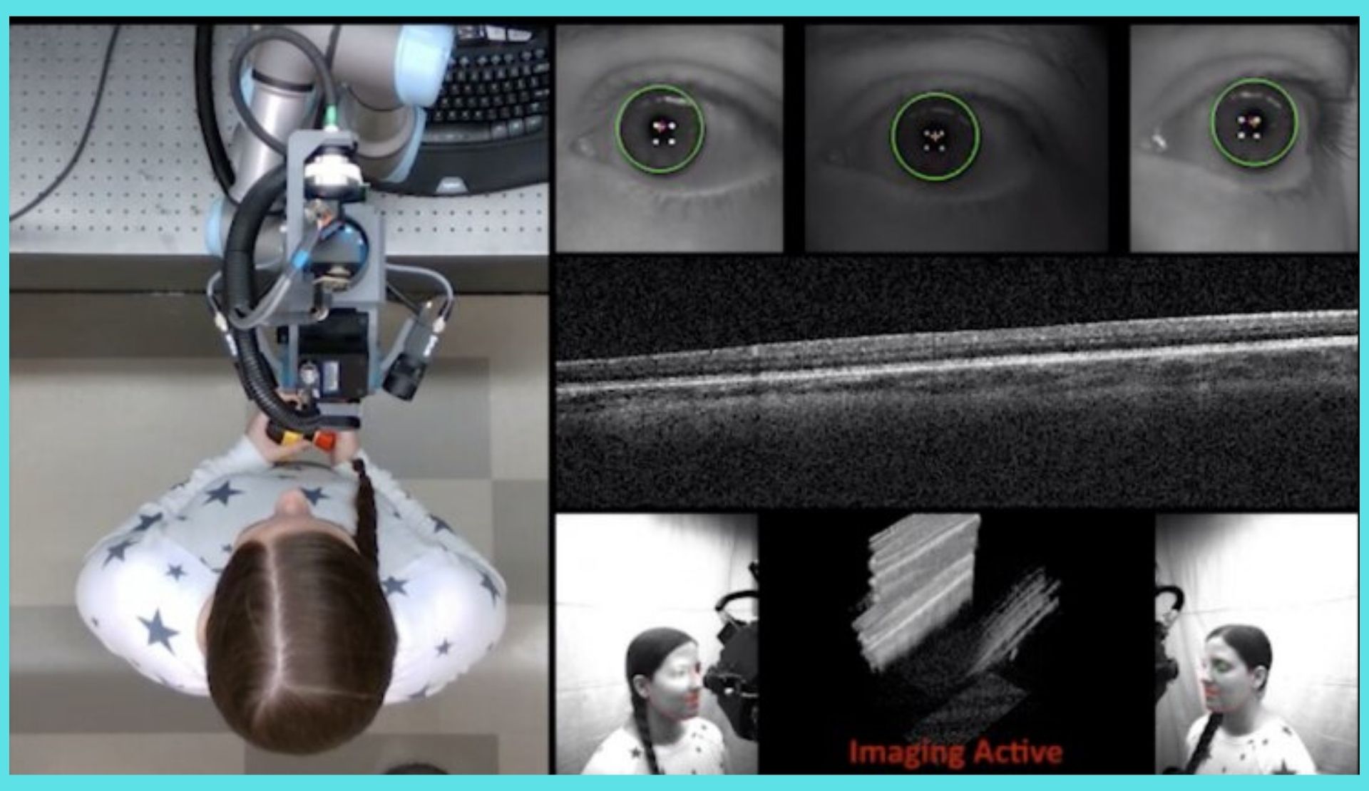 1 / 1O scanner de OCT recém-desenvolvido da Duke é conectado a um braço robótico que pode mover o scanner para alinhá-lo perfeitamente com os olhos do paciente. O scanner requer menos de 10 segundos para digitalizar e criar imagens de cada olho. Crédito: Duke University